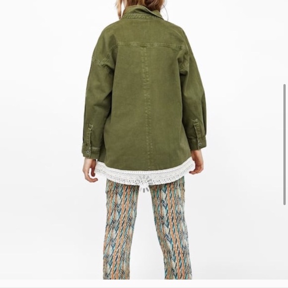 Zara Mixed Lace Overshirt - Picture 5 of 9